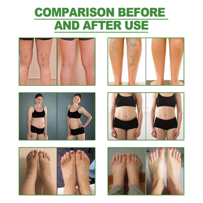 Nooru Body Cleansing Foot Pads